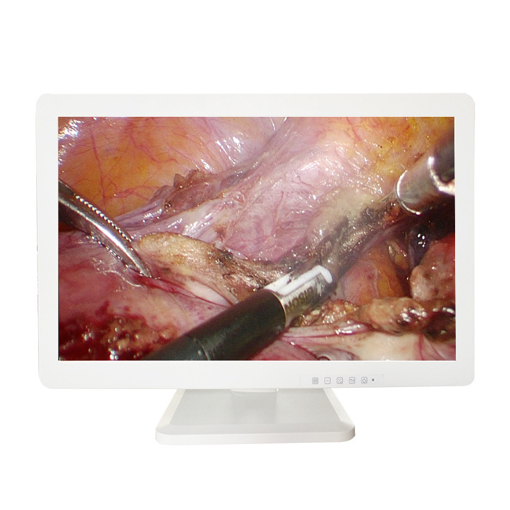 Medical LCD Image Display Screen 1080P 24 Inch HD Surgical Monitor for Laparoscopy Surgical