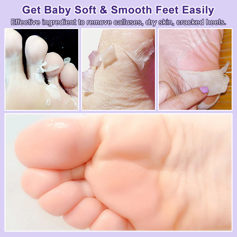 2024 Wholesale Foot Peel Mask for Dry Cracked Feet Foot Peeling  Masks  Exfoliator Peel Off Calluses Dead Skin Callus Remover