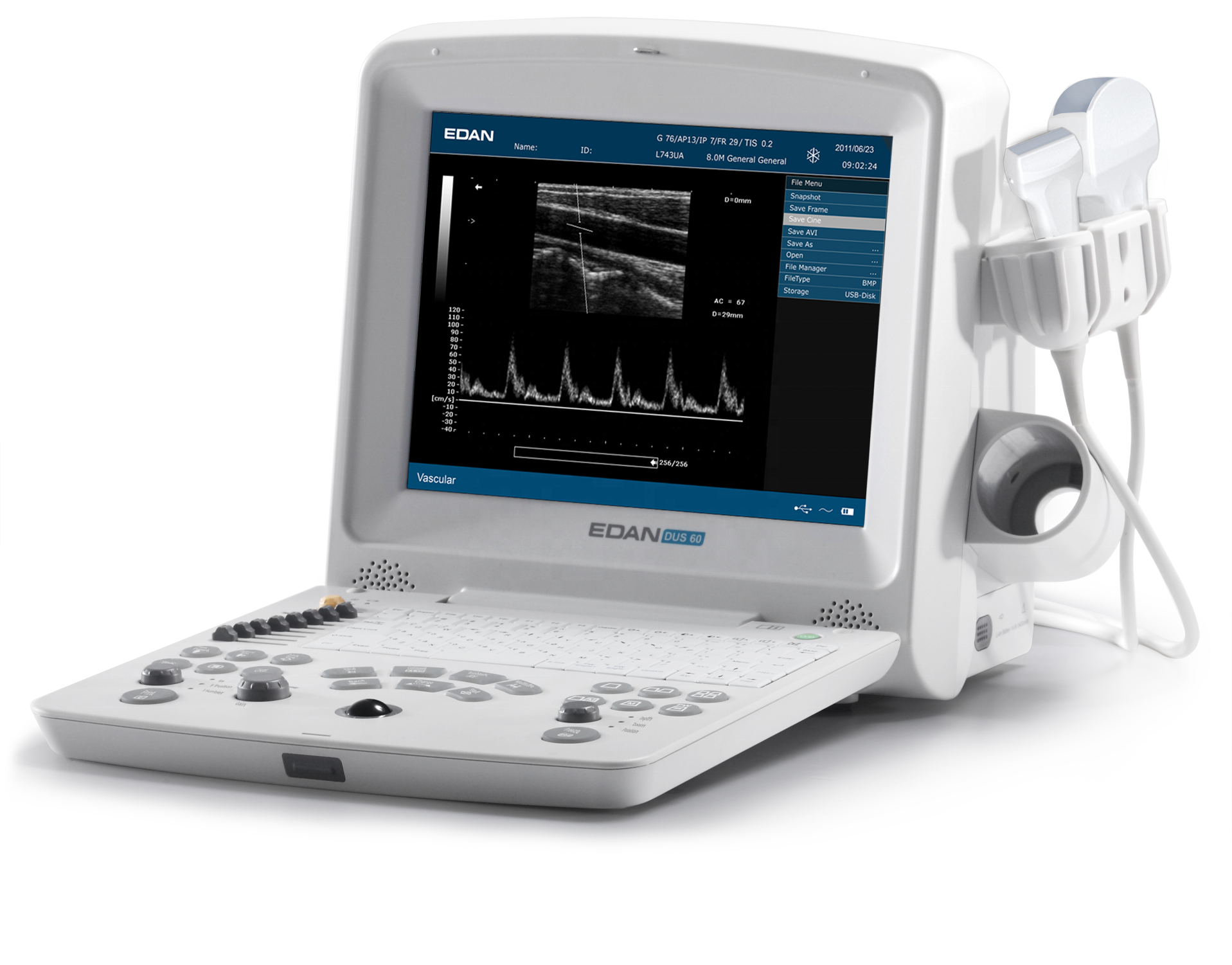 EDAN medical equipment lightweight ecocardiografo portatil Digital Ultrasonic Diagnostic Imaging System DUS60