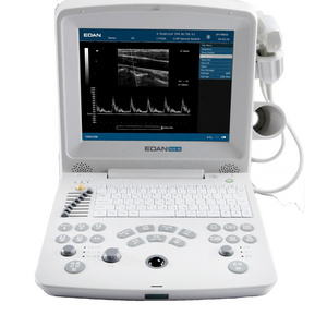 EDAN medical equipment lightweight ecocardiografo portatil Digital Ultrasonic Diagnostic Imaging System DUS60