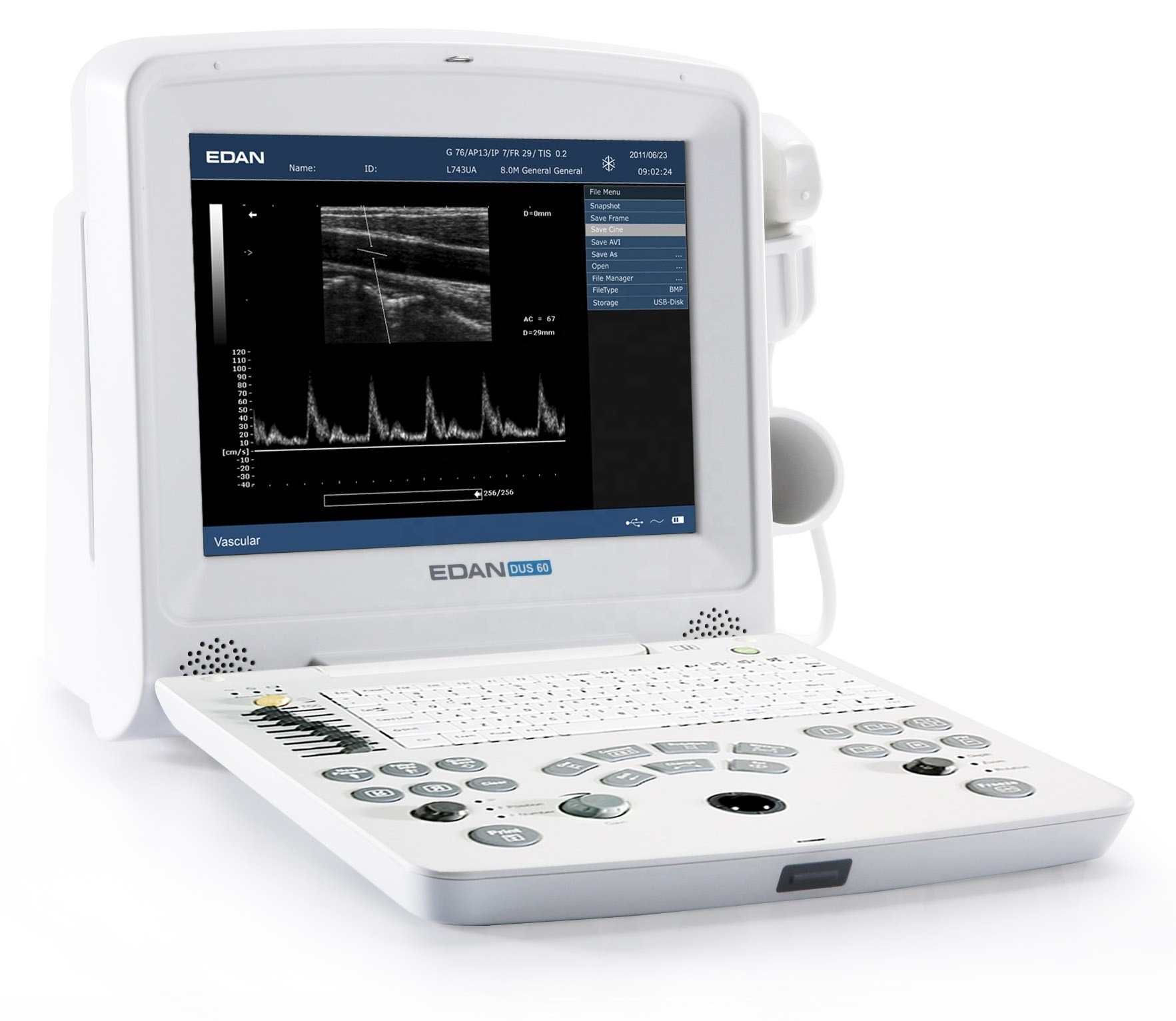 EDAN medical equipment lightweight ecocardiografo portatil Digital Ultrasonic Diagnostic Imaging System DUS60