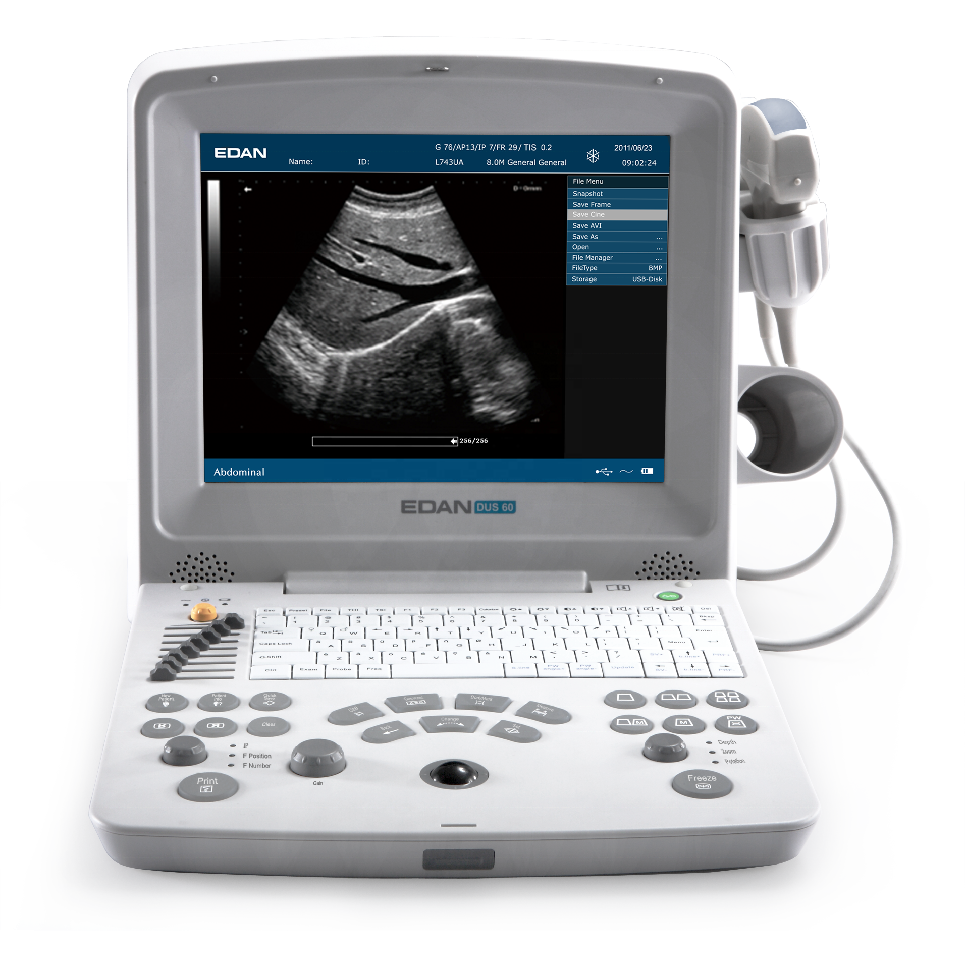 EDAN medical equipment lightweight ecocardiografo portatil Digital Ultrasonic Diagnostic Imaging System DUS60