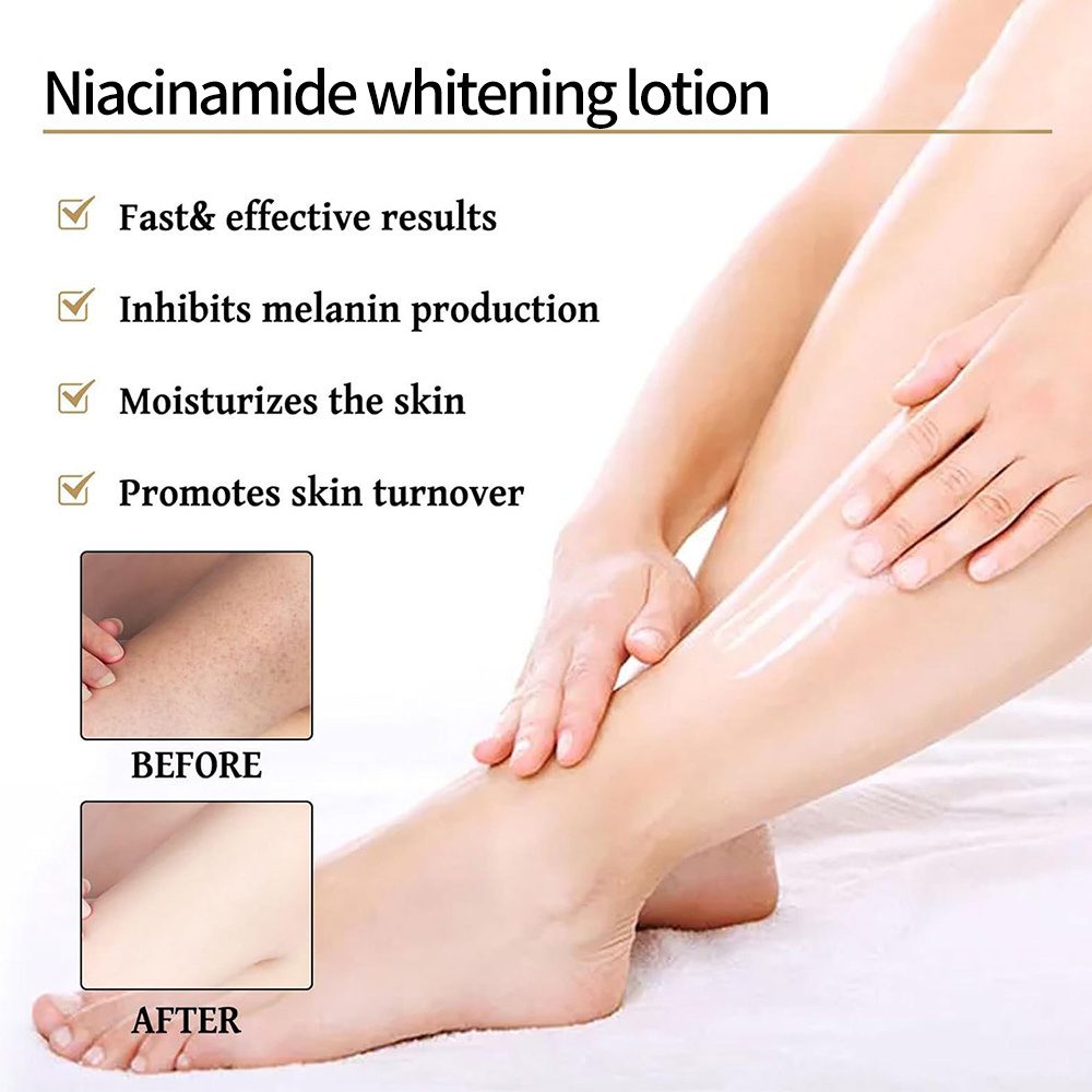 Herbicos OEM/ODM Private Brand Whitening Removing Yellowing Brightening Improving Dull Skin Tone Niacinamide Whitening Emulsion