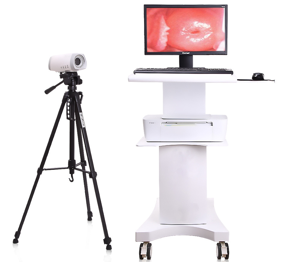 Trolley Type Colposcop with HD Camera , Video Colposcope, Digital Electronic Colposcopy Apparatus