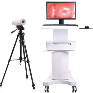 Trolley Type Colposcop with HD Camera , Video Colposcope, Digital Electronic Colposcopy Apparatus