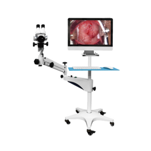 Colposcope Hd Video Colposcope Vaginal Camera for Vagina