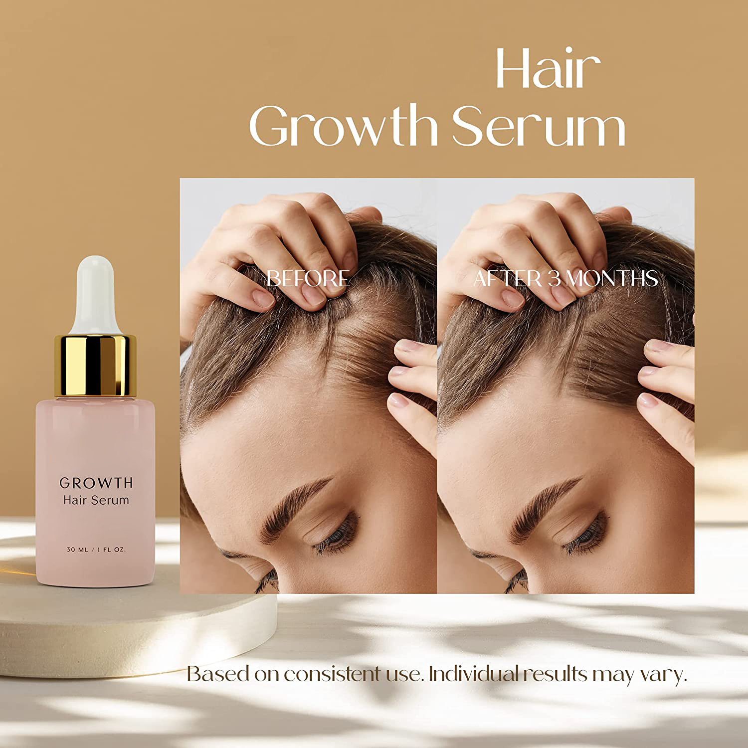 Hair Growth Serum Reduces Dandruff Moisturizing Oil Drops Private Label Biotin Serum Bottles Hair Oils For Hair Growth