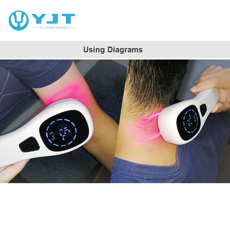 YJT handheld laser therapy treat osteoarthritis