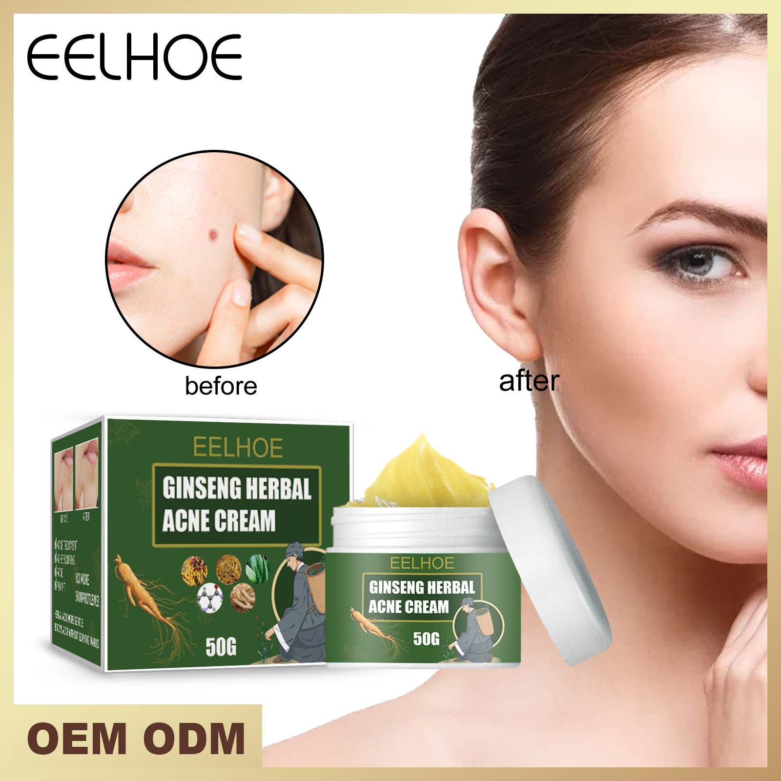 Herbal acne cream thailand face cream papaya whitening face cream  Dispel acne and fade acne marks