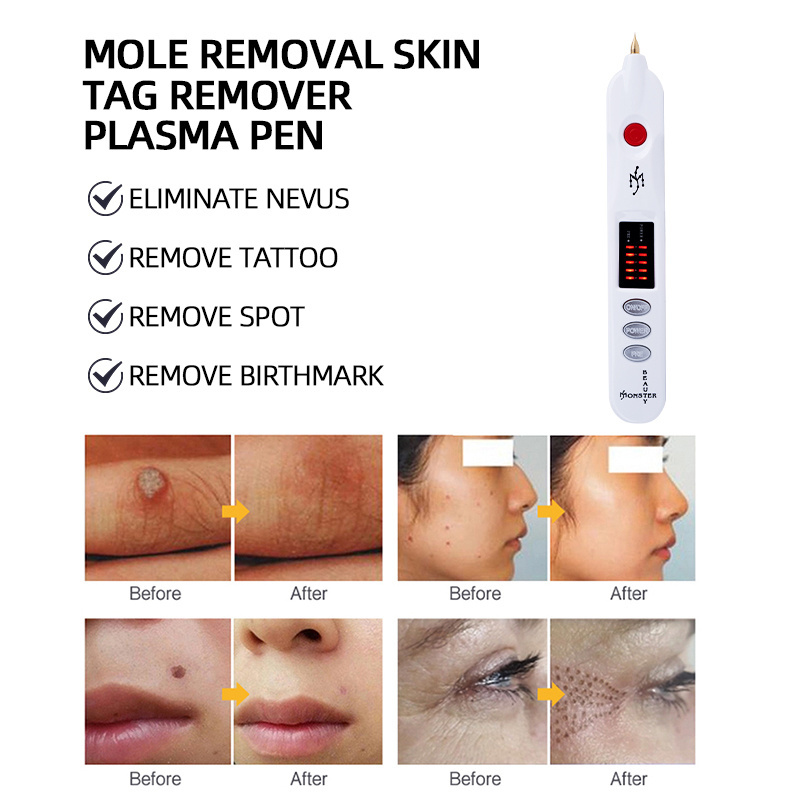 Wholesale Portable Spot Removal Fibroblast Plasma Lift Pen for Skin Rejuvenation