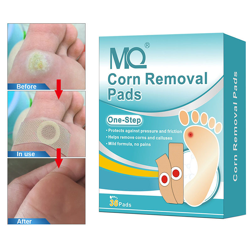 Chinese medicine wholesale 24/36/48pcs per box foot callus remover foot care corn removal