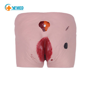 Medical science teaching model decubitus ulcer medical training model medical nursing manikin decubitus wound care model