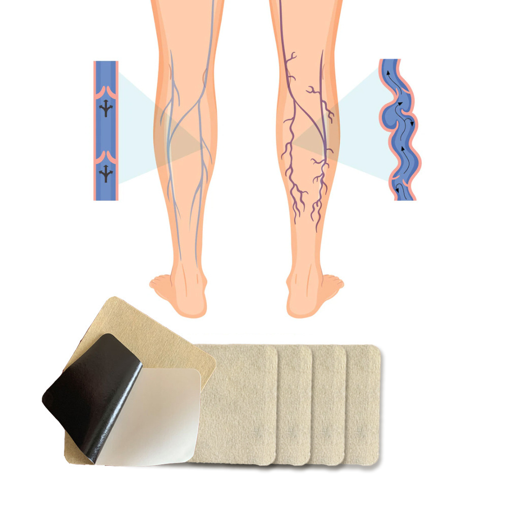 OEM Leg Veins Pain Relieve Improves Blood Circulation Varicose Veins Patch