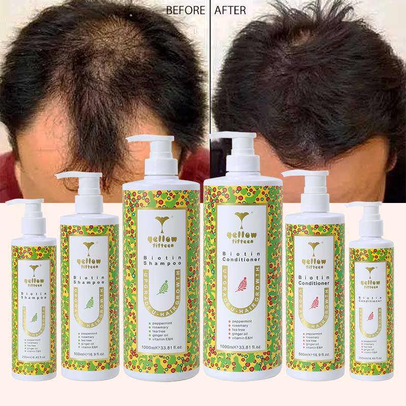 Wholesale Manufacturer Peppermint Rosemary Hair Growth Shampoo Organic Ginger Black Hair Biotin Shampoo for Hair Growth