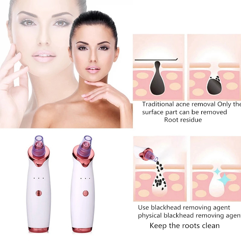 Tech gadgets 2023 Electronic Facial Pore Cleaner Electric Vacuum pimples acne Blackhead removal machine