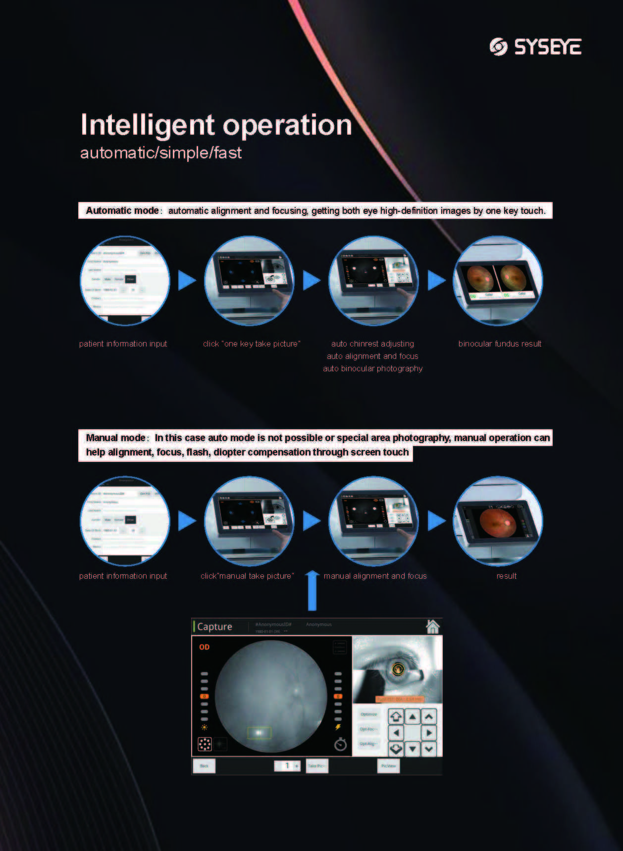 Manufacturer Price Tabletop Ophthalmic Equipment Digital Non Mydriatic Retinal Camera Fundus Camera