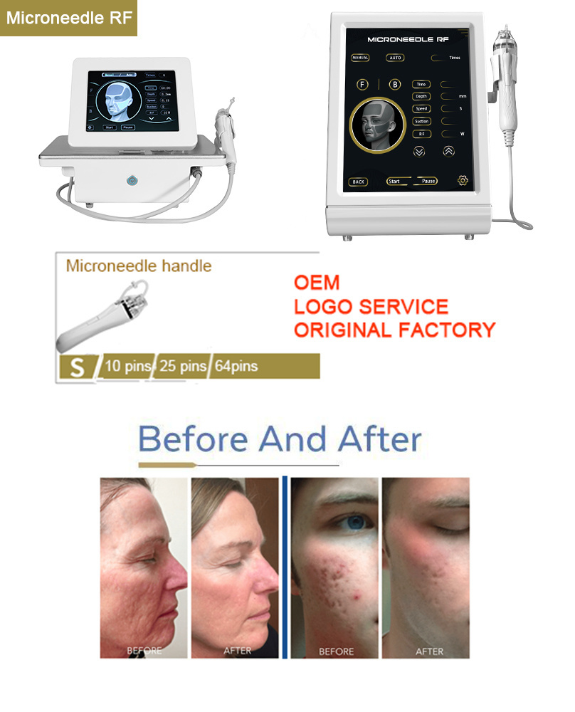 Hot Selling High Radio Frequency Facial Machine White Inmode Morpheus 8 Machine 2023 For Sale