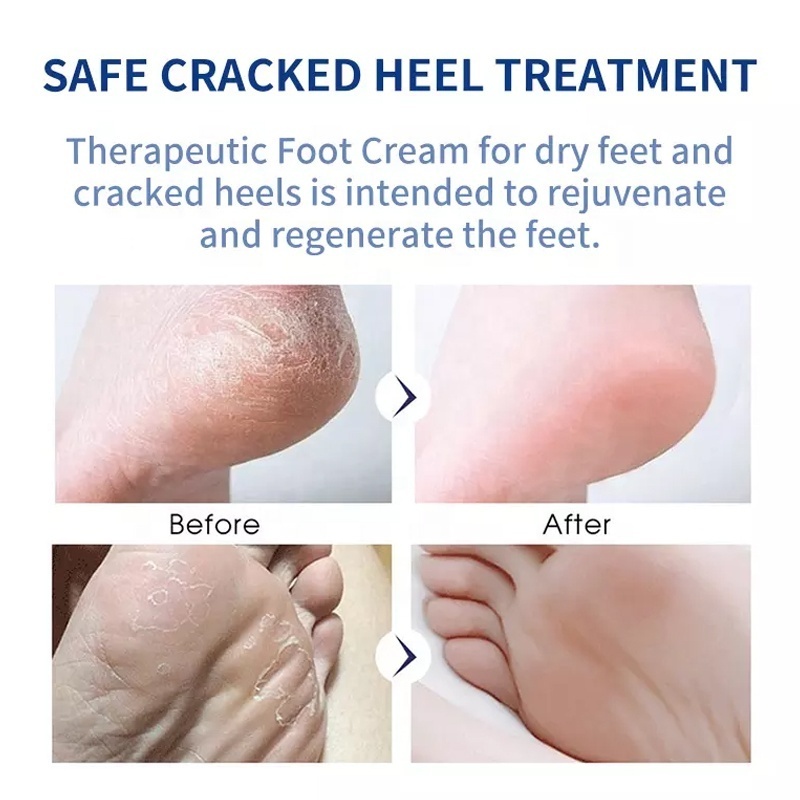 Wholesale Foot Care Cream For Cracked Heels Exfoliating Anti Crack Peeling Dead Skin Removal Foot Repair Whitening Foot Cream