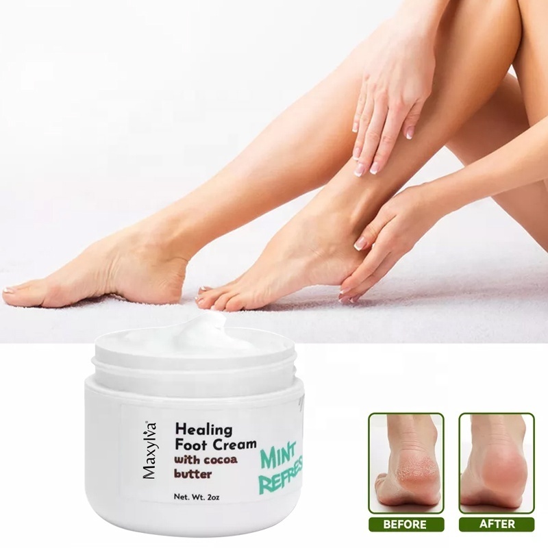 Wholesale Foot Care Cream For Cracked Heels Exfoliating Anti Crack Peeling Dead Skin Removal Foot Repair Whitening Foot Cream