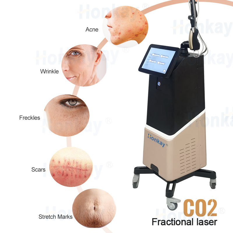 Big Sales Co2 Fractional Laser Anti-Aging Wrinkle Removal Machine Korea Facial Skin Care Co2 Fractional Laser Prices