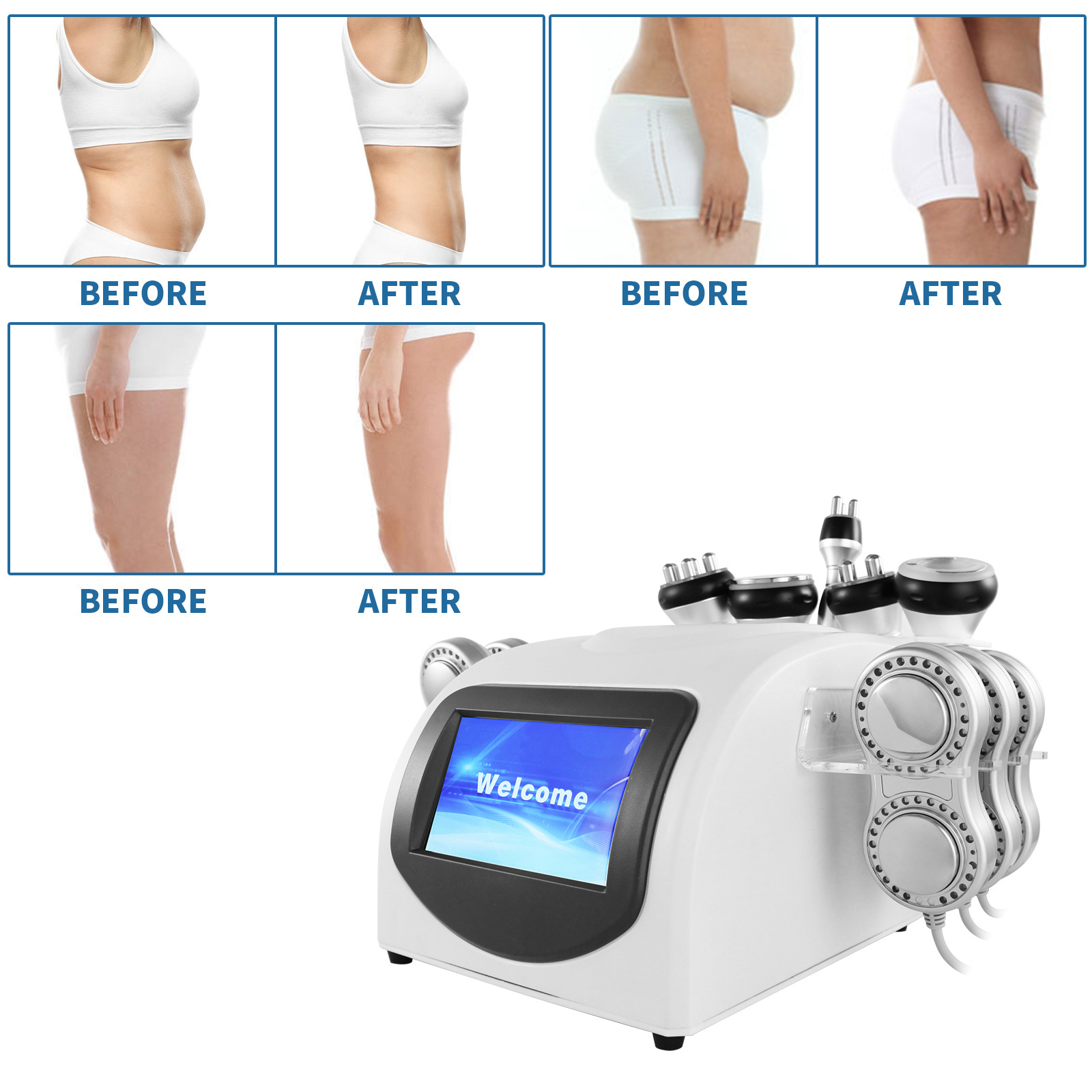 Best selling 6 in 1 40k ultrasonic cavitation laser kim 8 new body fat cavitation rf vacuum slimming machine