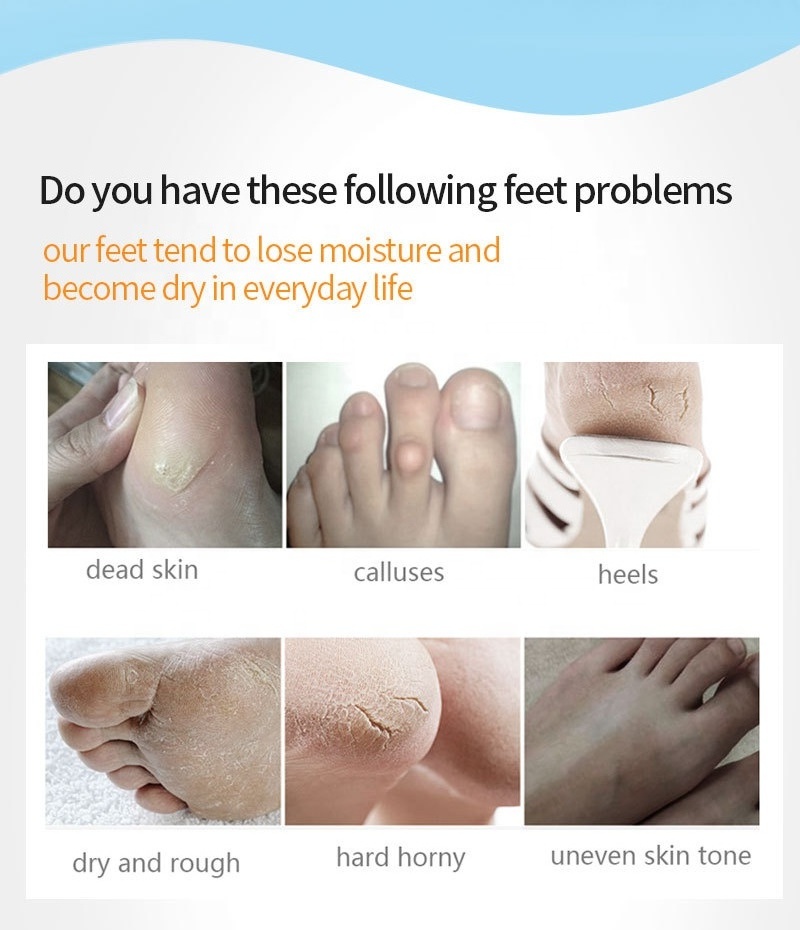 Free Sample Exfoliating Foot Peel Mask Lavender Exfoliating Socks Baby Care Pedicure Socks Remove Dead Skin foot mask