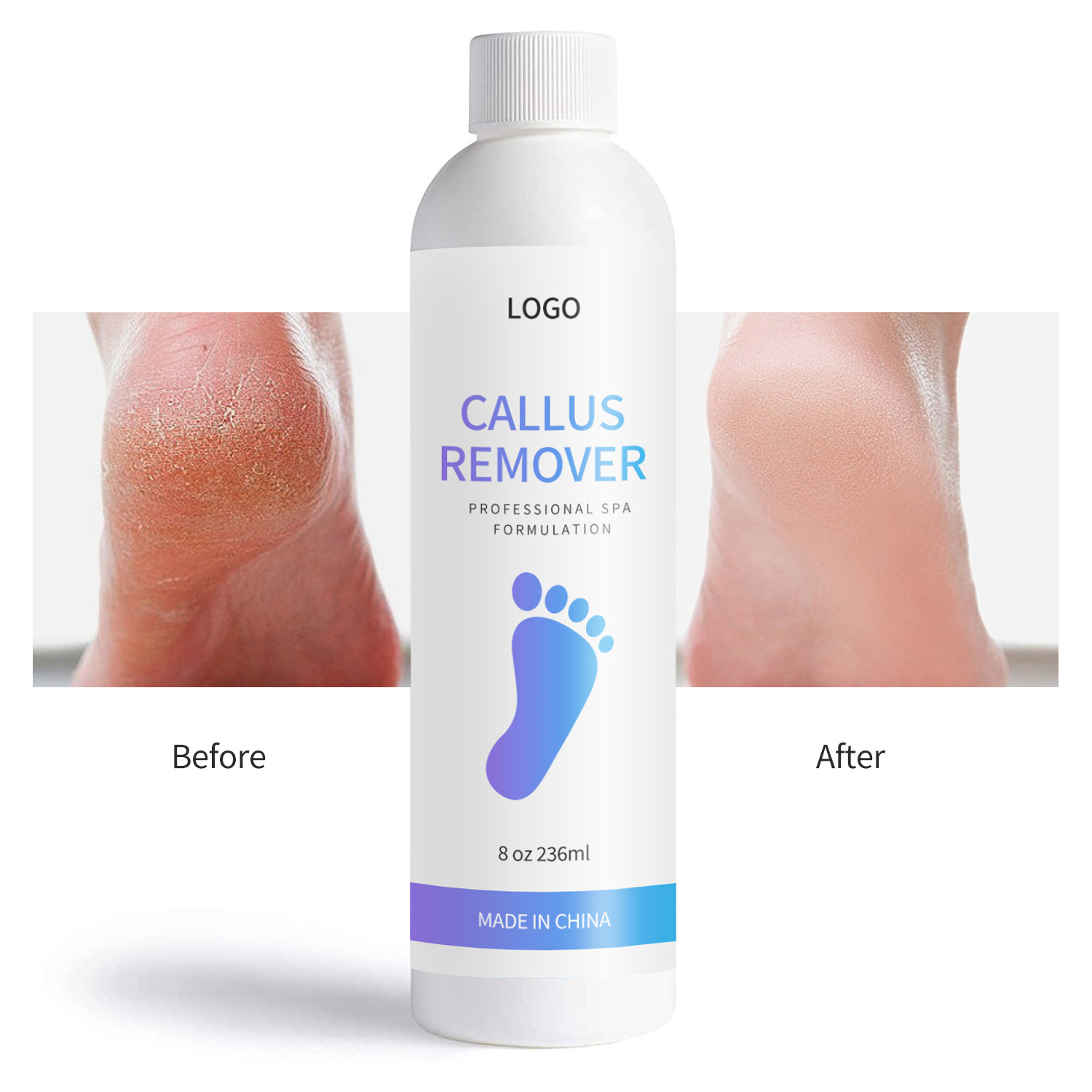 Private Label Professional Foot Care Remover Dead Skin Eliminator Exfoliator Strength Callus Remover Gel