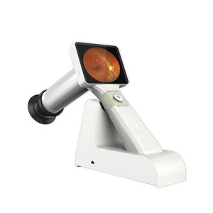 HFC-01A Medical Diagnostic Ophthalmic Instrument Eye Handheld Portable Retinal Fundus Camera