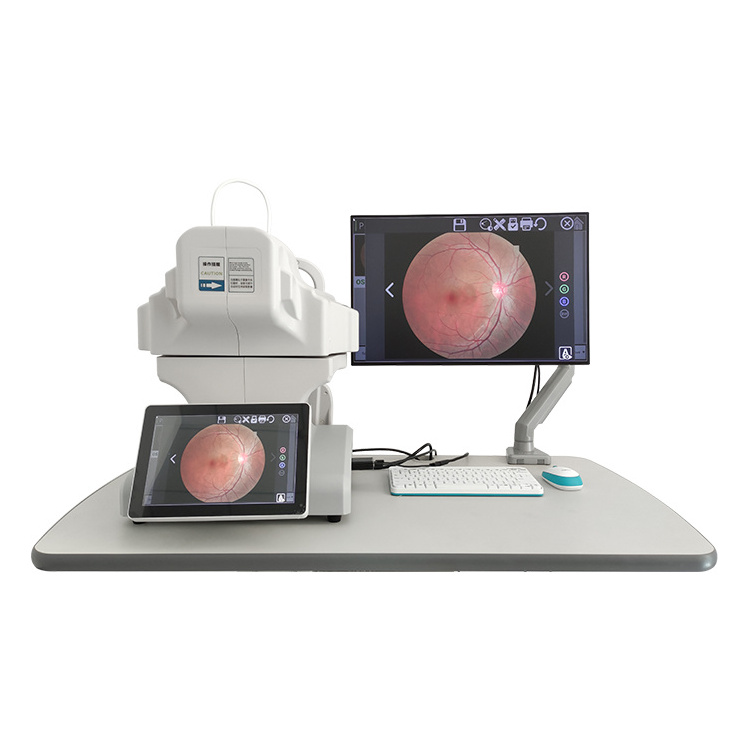 Best Price Reticam-3100 Ophthalmic Non-mydriatic Automatic Digital Retinal Fundus Camera