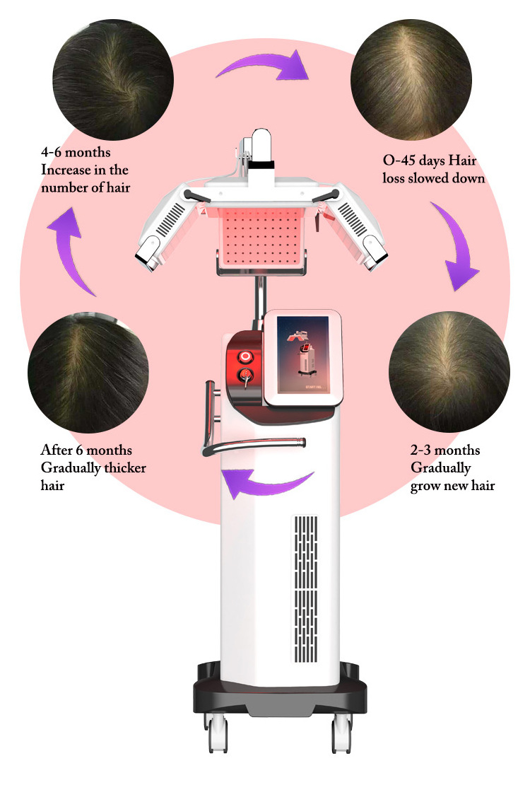 Maquinas De Estetica Doeid Laser Max 650NM Crecimiento Cabello Treatment Care Equipment Hair Growth Led Machine