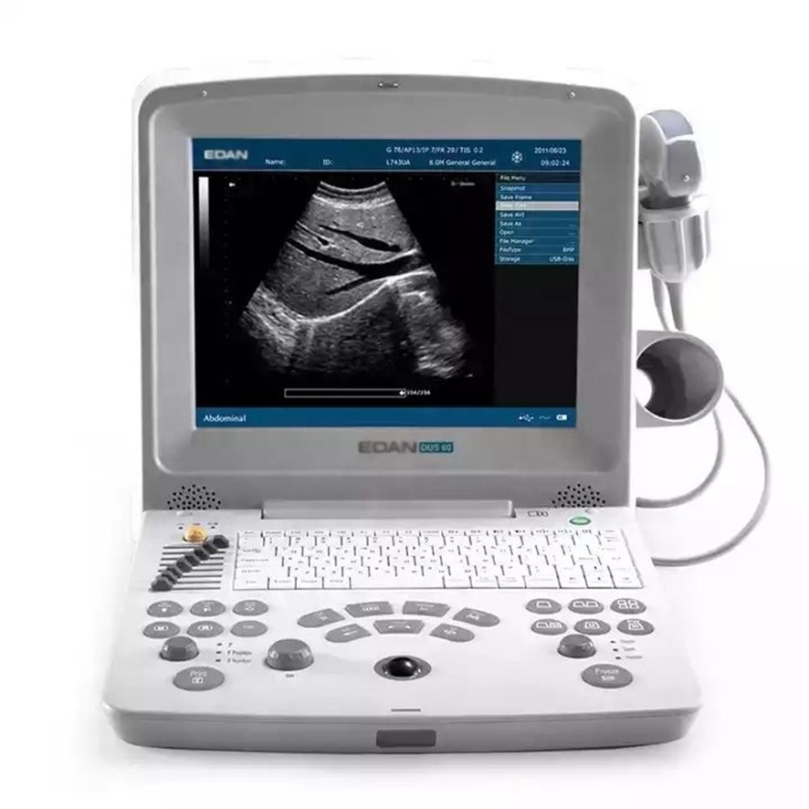 Edan DUS60 Edan Dus60 Dus 60 Ultrasound Machine Portable