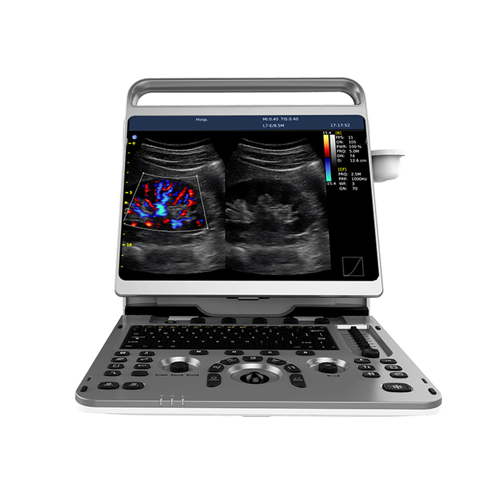 Factory Price Chison Ebit 50 Equipos De Ultrasonido Medical 3d 4d Color Doppler System With Convex Probe