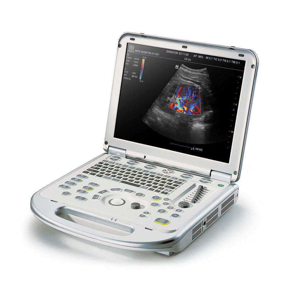 M7 Mindray Professional Portable 3d/4d Color Doppler Ultrasound Machine