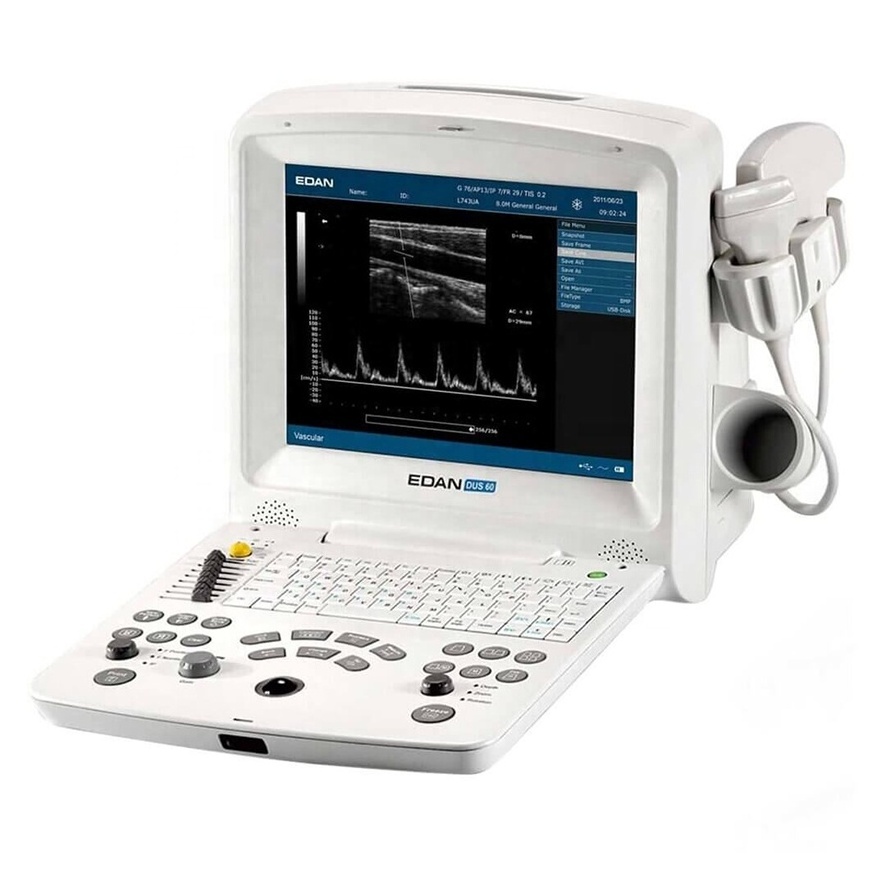 Edan DUS60 Edan Dus60 Dus 60 Ultrasound Machine Portable