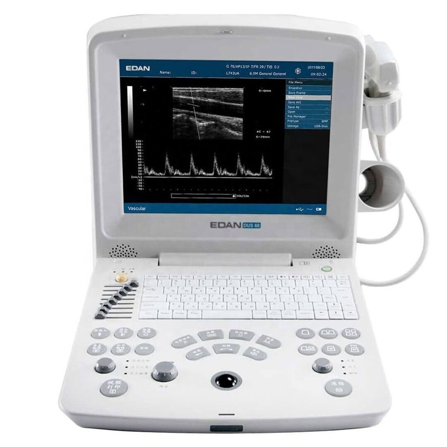 Edan DUS60 Edan Dus60 Dus 60 Ultrasound Machine Portable