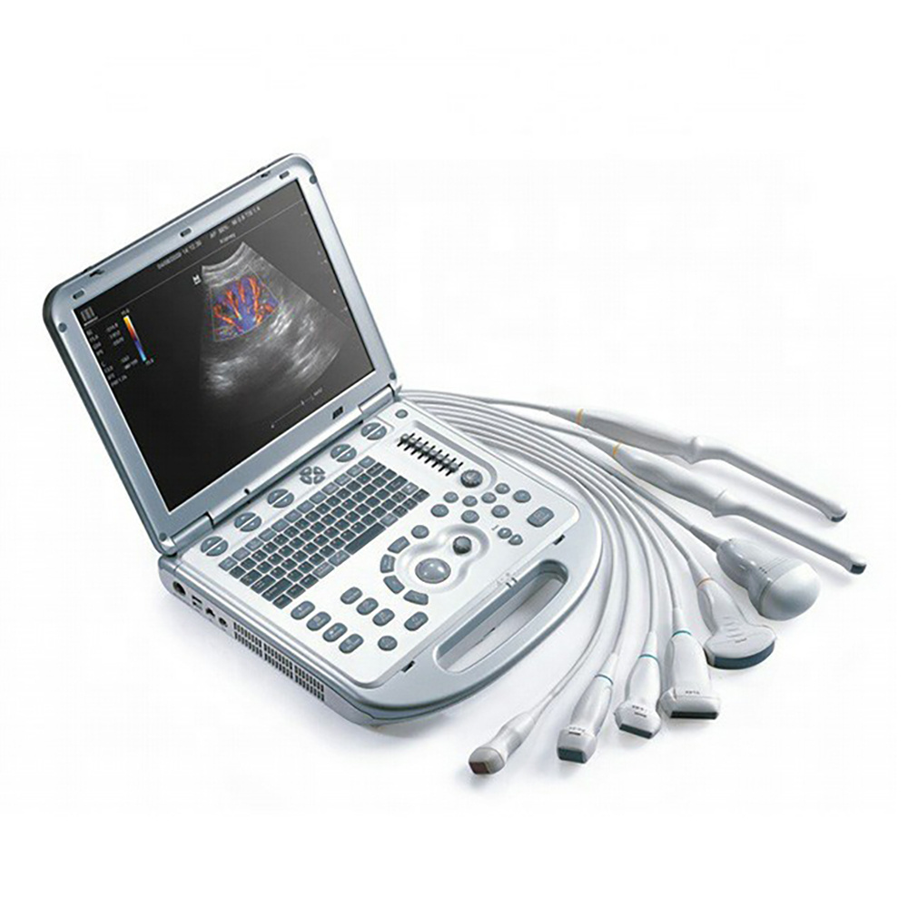 M7 Mindray Professional Portable 3d/4d Color Doppler Ultrasound Machine