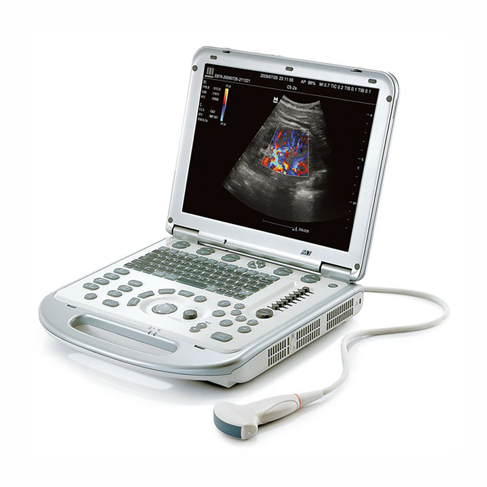 M7 Mindray Professional Portable 3d/4d Color Doppler Ultrasound Machine