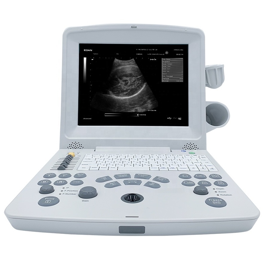 Edan DUS60 Edan Ultrasound Machine /ultrasound Portable Edan Dus60 For Vet