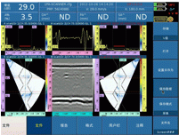 13.6 inch TFT-LCD Digital Phased array ultrasonic flaw detector