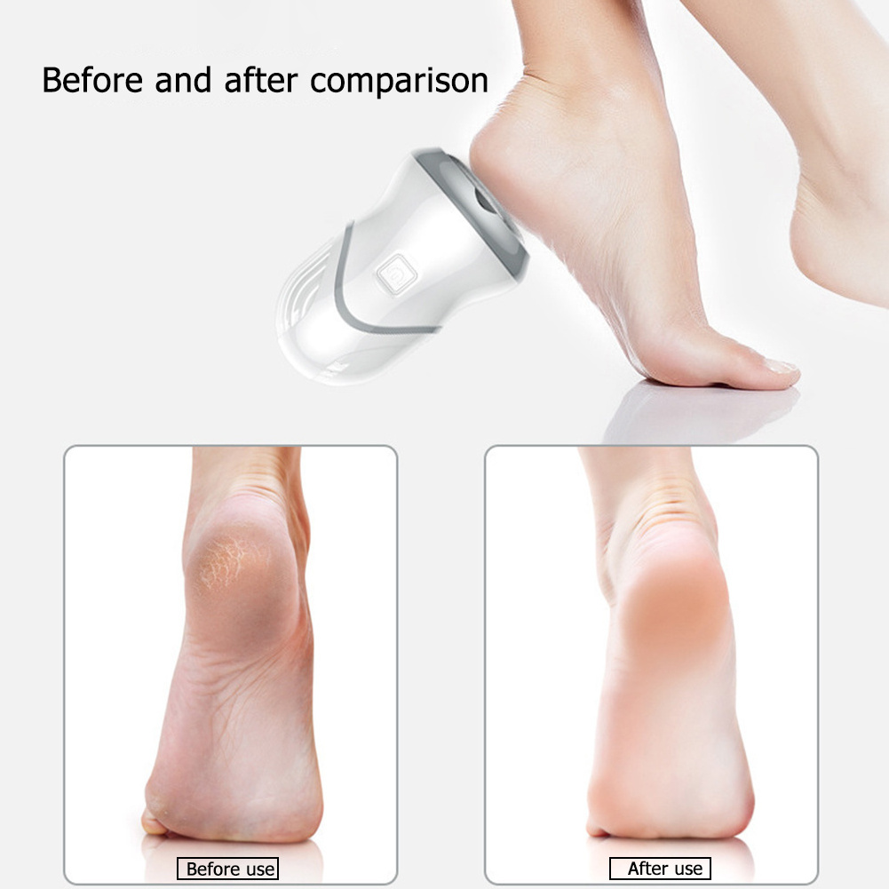 Wholesale Electric Callus Remover Machine Feet Removes Calluses Foot Grinder Electric Pedicure Foot Callus Gel Remover