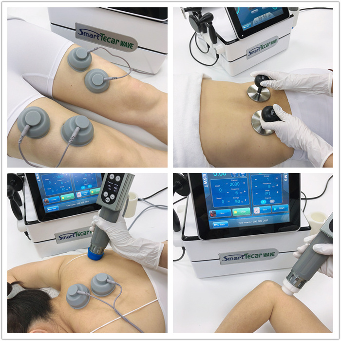 GOMECY 448Khz Thermal Rf Tecarterapia Physiotherapy Medical Cet Ret Rf Machine 0 To 160 J Tecar Therapy Physiotherapy Machine