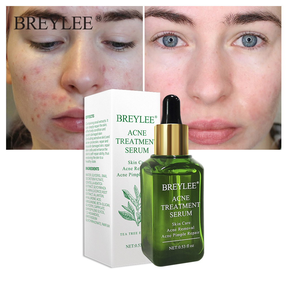 BREYLEE best effect tea tree oil acne treatment serum for ance removal  Natural Japan Sakura  serum