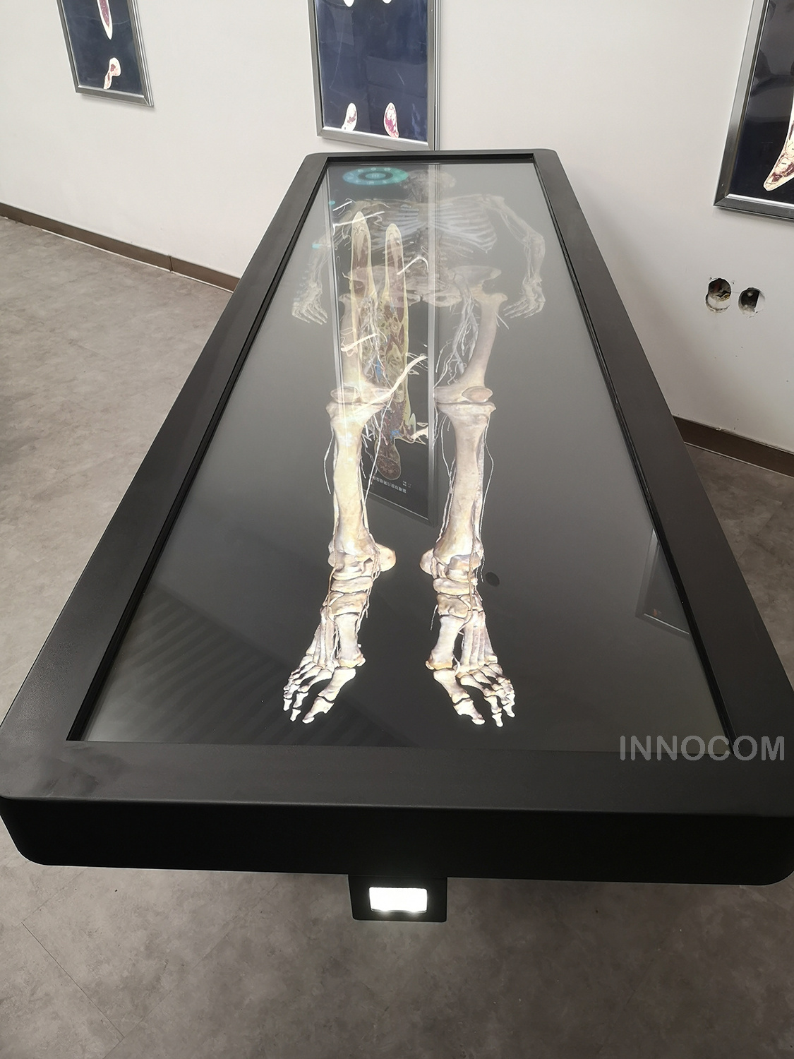 Medical Education Teaching Human 3D Anatomy Virtual System Digital Body Anatomy System Virtual Anatomage Table