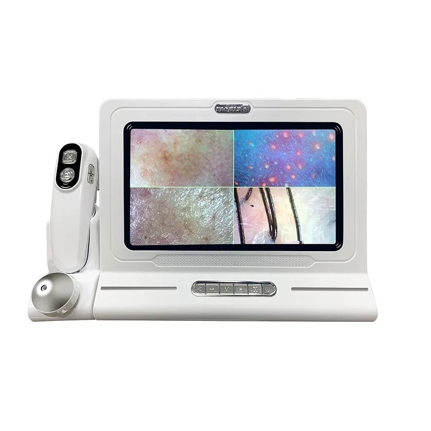 Multi-functional Mini Skin Analyzer Hair Follicle Scalp Detector Portable Skin and Hair Analyzer at Best Prices from US