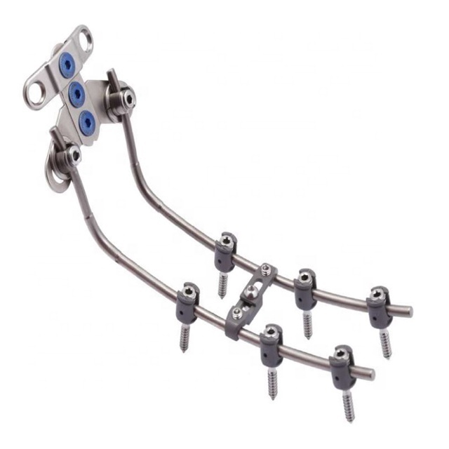 High quality Spinal Fixation System - Occipito-Cervico-Thoracic