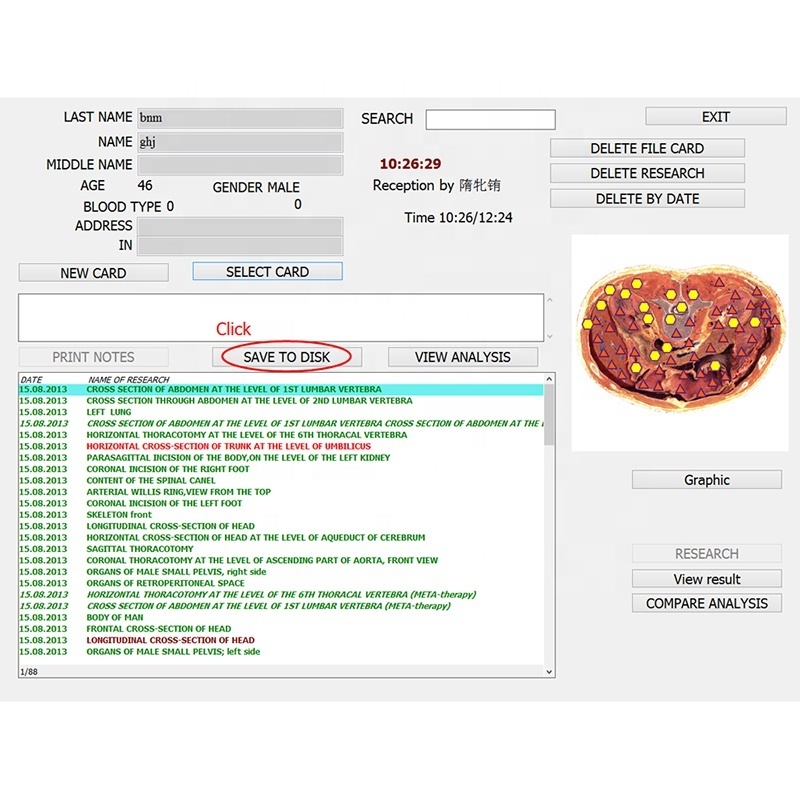 GY-518D 8d Nls Bioresonance Health Scan Body Health Analyzer