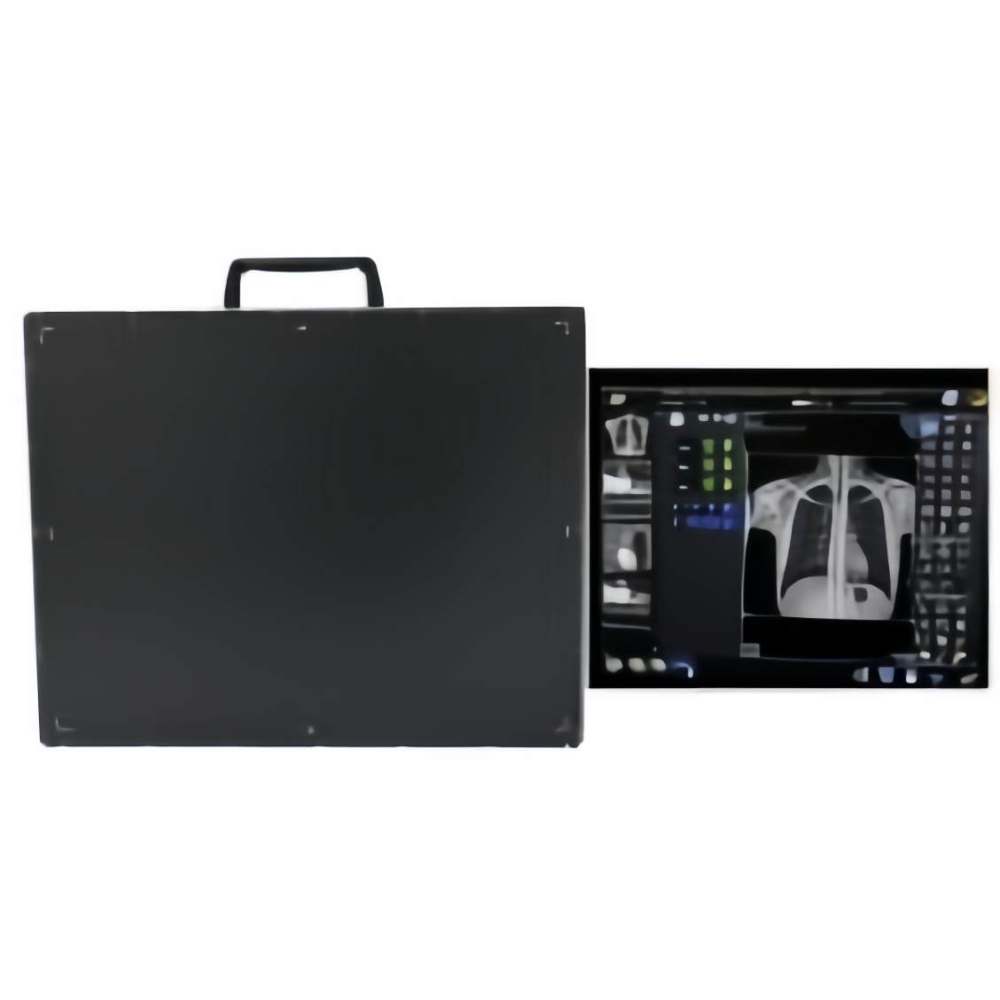 30KW Profesional Medical Radiology Diagnostic Digital Xray Equipment RX Digital X-ray Machine