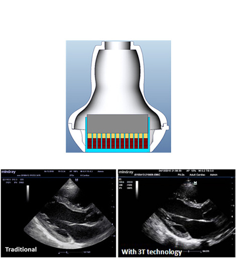 Mindray M7 3D 4D Color Doppler Ultrasound Scanner Machine Laptop Ecografo Probe Portable Medical Ultrasound Instruments Price