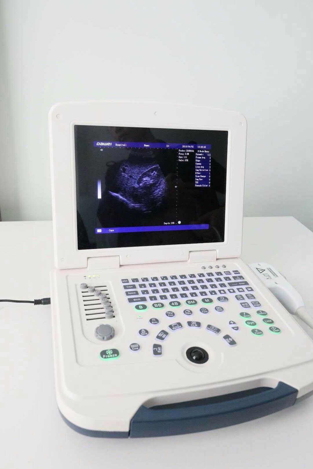 dawei dw-580 Black And White Ultrasonic Small Size Portable Ultrasound machine ultrasonido Scanner With Convex Probe