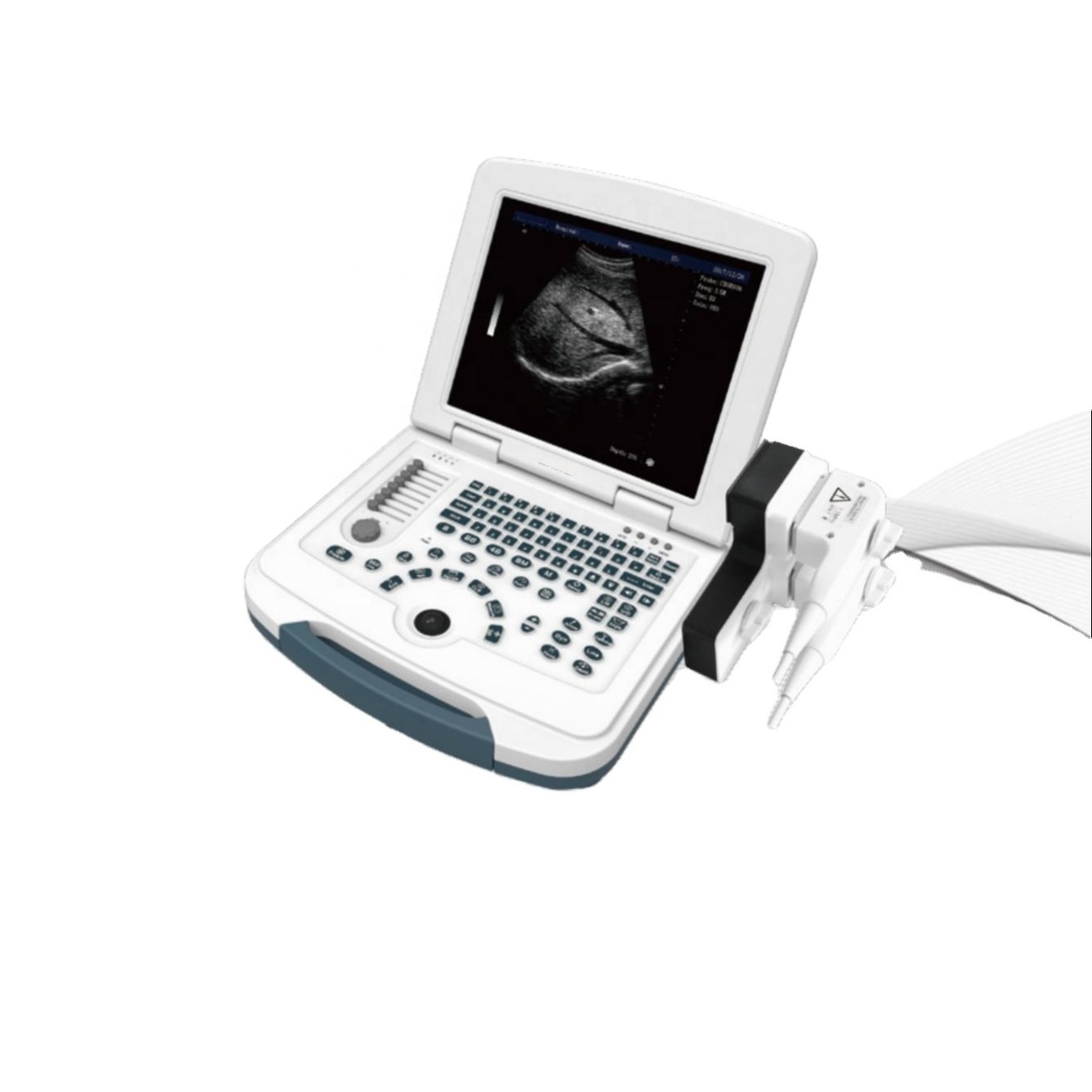 dawei dw-580 Black And White Ultrasonic Small Size Portable Ultrasound machine ultrasonido Scanner With Convex Probe